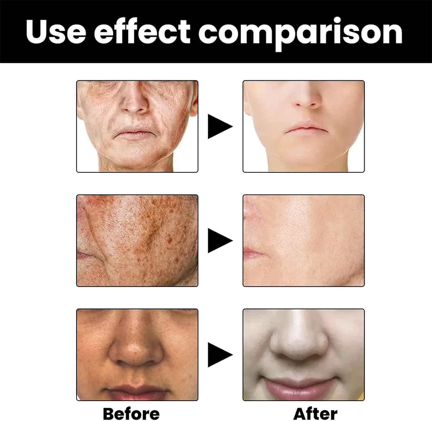 Eelhoe - Melanin Correcting Serum Noon Marrt