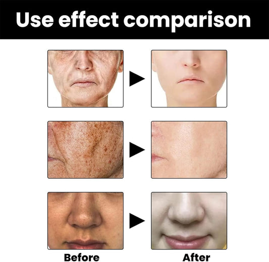 Eelhoe - Melanin Correcting Serum Noon Marrt