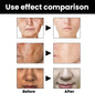 Eelhoe - Melanin Correcting Serum Noon Marrt