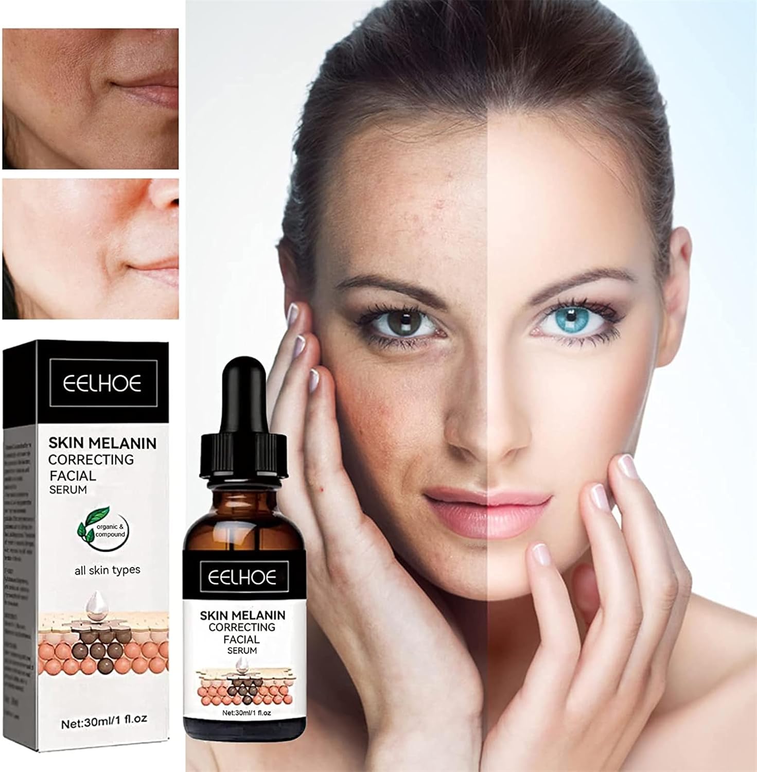 Eelhoe - Melanin Correcting Serum Noon Marrt