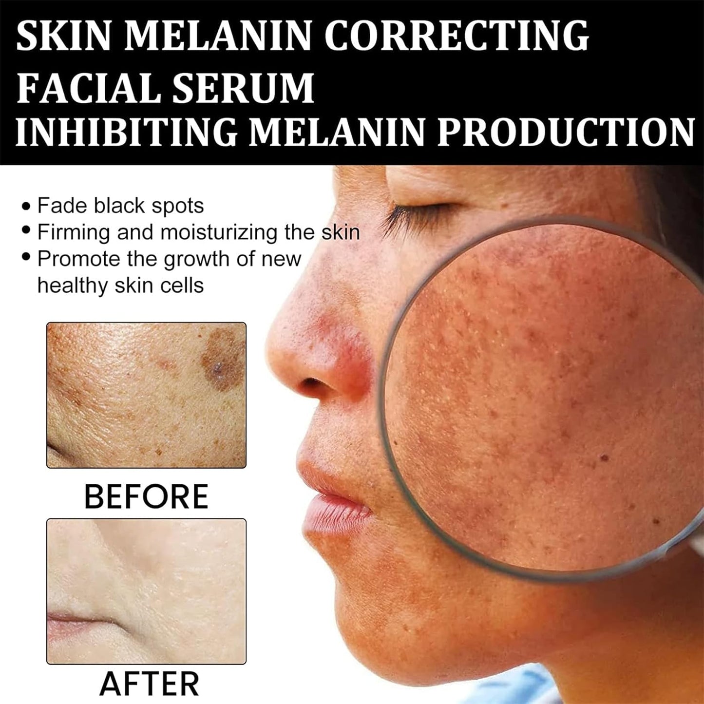 Eelhoe - Melanin Correcting Serum Noon Marrt